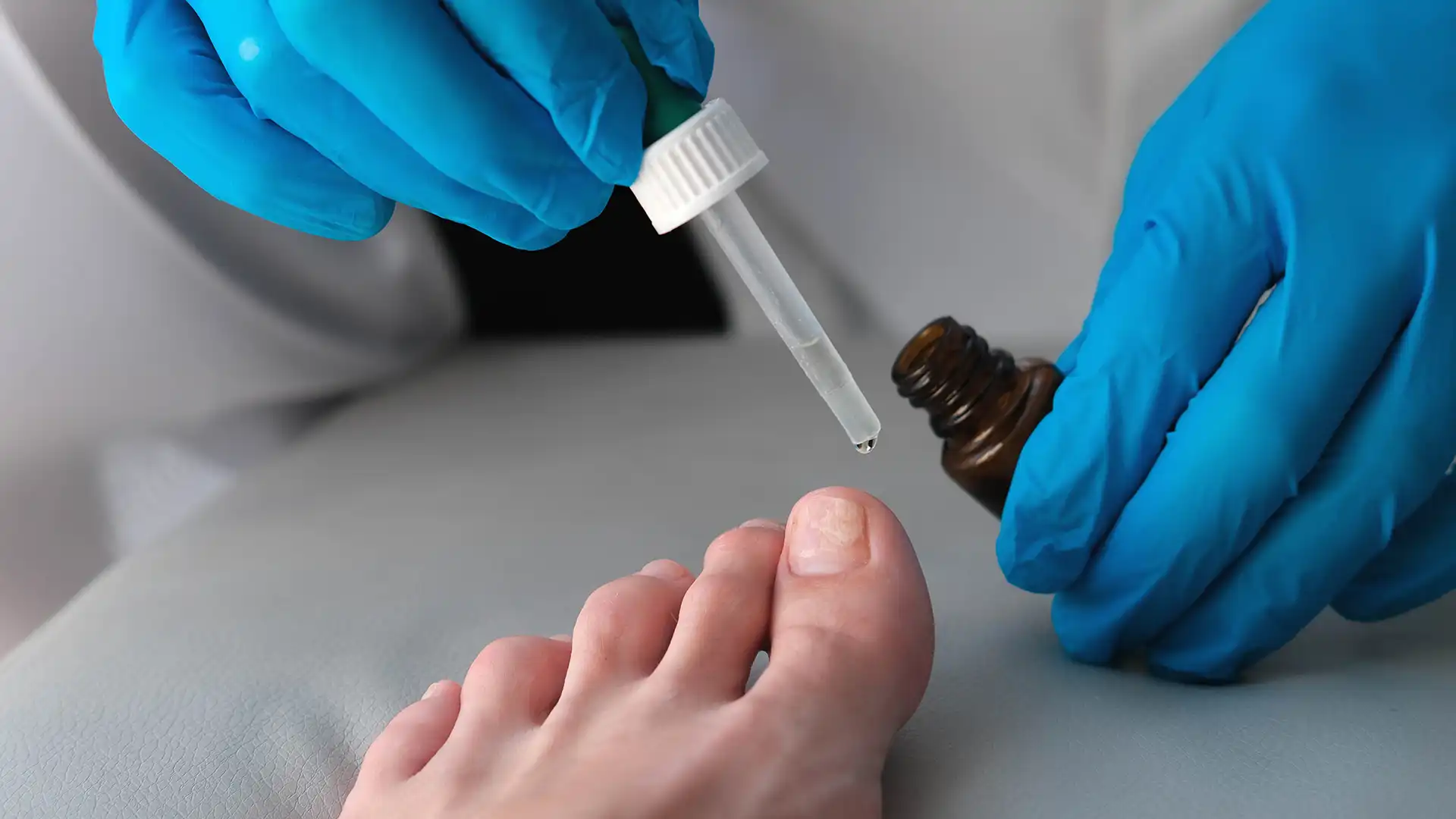 Treating Ingrown Toenail Pus | Hills District Podiatry
